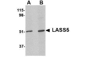 Image no. 1 for anti-LAG1 Homolog, Ceramide Synthase 5 (LASS5) (N-Term) antibody (ABIN341704) (LASS5 anticorps  (N-Term))
