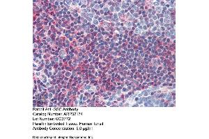 Immunohistochemistry with Human Tonsil lysate tissue at an antibody concentration of 5.
