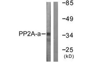 Western blot analysis of extracts from A549 cells, using PP2A-alpha (Ab-307) Antibody. (PPP2CA anticorps  (AA 260-309))