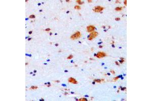 Immunohistochemical analysis of p27 Kip1 staining in human brain formalin fixed paraffin embedded tissue section.