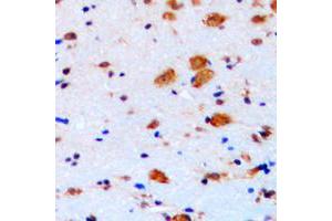 Immunohistochemical analysis of p27 Kip1 staining in human brain formalin fixed paraffin embedded tissue section. (CDKN1B anticorps  (C-Term))