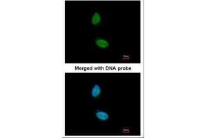 ICC/IF Image Immunofluorescence analysis of paraformaldehyde-fixed HeLa, using ZNF134, antibody at 1:200 dilution.