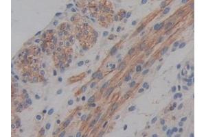 Detection of ABCA1 in Mouse Uterus Tissue using Polyclonal Antibody to ATP Binding Cassette Transporter A1 (ABCA1)