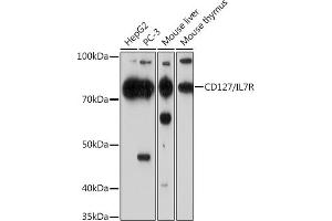 Western blot analysis of extracts of various cell lines, using CD127/IL7R Rabbit mAb (ABIN7268005) at 1:1000 dilution.