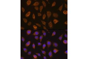 Immunofluorescence analysis of L929 cells using VHL Rabbit pAb (ABIN7271338) at dilution of 1:100.