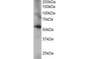 Western Blotting (WB) image for anti-Coronin, Actin Binding Protein, 1C (CORO1C) (C-Term) antibody (ABIN2465550) (CORO1C anticorps  (C-Term))