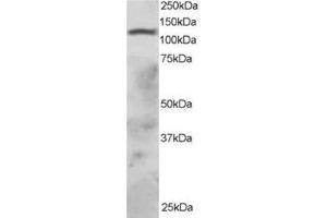 Image no. 1 for anti-Ring Finger Protein 31 (RNF31) (C-Term) antibody (ABIN374257) (RNF31 anticorps  (C-Term))