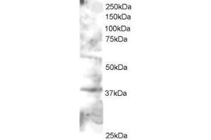 Western Blotting (WB) image for anti-GRB2-Related Adaptor Protein 2 (GRAP2) (C-Term) antibody (ABIN2465791) (GRAP2 anticorps  (C-Term))