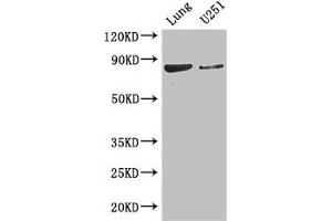 Western Blot Positive WB detected in: Mouse lung tissue, U251 whole cell lysate All lanes: YTHDC1 antibody at 3. (YTHDC1 anticorps  (AA 89-153))