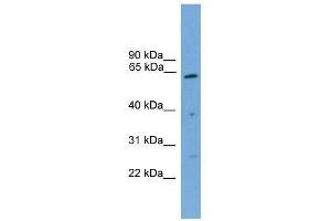 PSMD3 antibody used at 0. (PSMD3 anticorps  (Middle Region))