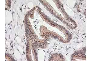 Image no. 1 for anti-Monoglyceride Lipase (MGLL) antibody (ABIN1499437) (MGLL anticorps)