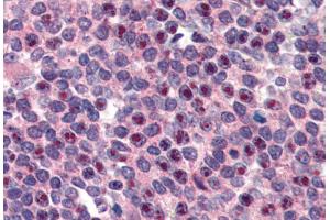 ABIN190919 (3µg/ml) staining of paraffin embedded Human Spleen. (FANCG anticorps  (C-Term))