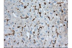 Immunohistochemical staining of paraffin-embedded prostate tissue using anti-ALDH3A1 mouse monoclonal antibody. (ALDH3A1 anticorps)