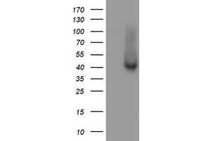 Western Blotting (WB) image for anti-Tubulin Folding Cofactor C (TBCC) antibody (ABIN1501323) (TBCC anticorps)