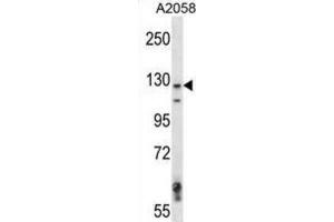 Western Blotting (WB) image for anti-Mitogen-Activated Protein Kinase Kinase Kinase 6 (MAP3K6) antibody (ABIN2997620) (MAP3K6 anticorps)