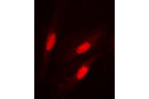 Immunofluorescent analysis of Beta-catenin (pS37) staining in HeLa cells.