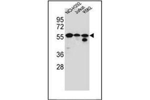 Western blot analysis of FOXN2 / HTLF Antibody (N-term) in NCI-H292, Jurkat, K562 cell line lysates (35ug/lane). (FOXN2 anticorps  (N-Term))