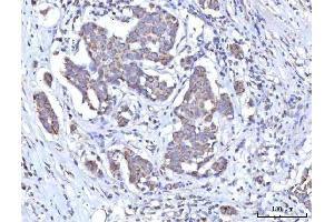 IHC analysis of C18orf22/RBFA using anti-C18orf22/RBFA antibody (ABIN7600106). (RBFA anticorps  (AA 15-319))