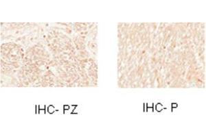 Sample Type:  Human Optic Nerve and Spinal CordCellular Target: Oligoden Drocyte Lineage cells   Dilution:  1:1000
