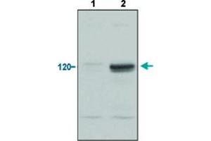 Western Blot analysis of (1) normoxic and (2) hypoxic nuclear rat cell lysates with EPAS1 polyclonal antibody . (EPAS1 anticorps  (C-Term))