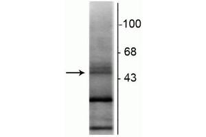 Western blot of rat hippocampal lysate showing specific immunolabeling of the ~48 kDa RAR-β isotype. (Retinoic Acid Receptor beta anticorps  (N-Term))