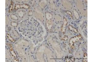 Image no. 2 for anti-Calmodulin-Like 5 (CALML5) (AA 1-147) antibody (ABIN599566) (CALML5 anticorps  (AA 1-147))