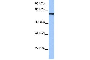 WB Suggested Anti-MLLT3 Antibody Titration:  0. (AF9 anticorps  (N-Term))
