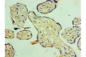 Immunohistochemistry of paraffin-embedded human placenta tissue using ABIN7170991 at dilution of 1:100 (SOCS1 anticorps  (AA 1-211))