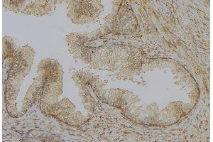 ABIN6277903 at 1/100 staining Mouse colon tissue by IHC-P.