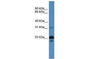 WB Suggested Anti-BASP1 Antibody Titration: 0. (BASP1 anticorps  (N-Term))