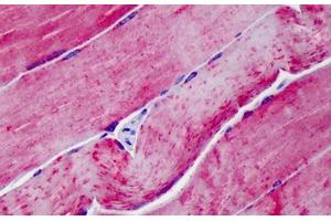 Human Skeletal Muscle: Formalin-Fixed, Paraffin-Embedded (FFPE)