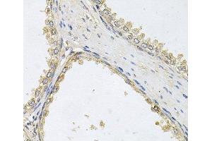 Immunohistochemistry of paraffin-embedded Human prostate using POMGNT1 Polyclonal Antibody at dilution of 1:100 (40x lens).