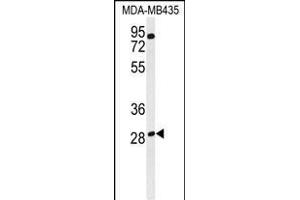 Western blot analysis of RRAGD Antibody (Center) (ABIN651150 and ABIN2840101) in MDA-M cell line lysates (35 μg/lane). (RRAGD anticorps  (AA 171-199))