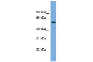 AK5 antibody used at 1 ug/ml to detect target protein. (Adenylate Kinase 5 anticorps  (N-Term))