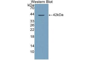 Western blot analysis of the recombinant protein. (XCL1 anticorps  (AA 23-113))