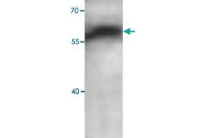 Western blot analysis of human fetal brain lysate with ADAM10 polyclonal antibody  at 1 : 1000 dilution. (ADAM10 anticorps  (C-Term))