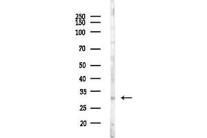 anti-Carbonic Anhydrase VB, Mitochondrial (CA5B) (C-Term) antibody