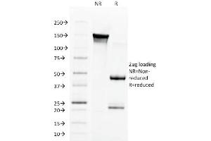 anti-Aurora Kinase B (AURKB) (AA 89-251) antibody