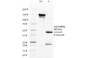 SDS-PAGE Analysis Purified Aurora B Mouse Monoclonal Antibody (AURKB/1592). (Aurora Kinase B anticorps  (AA 89-251))