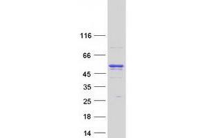 Validation with Western Blot