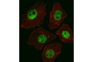 Fluorescent image of A549 cell stained with SOX2 Antibody (ABIN387798 and ABIN2843854)/SG110310. (SOX2 anticorps)