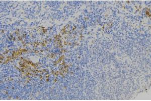 ABIN6277802 at 1/100 staining Human lymph node tissue by IHC-P. (S100A9 anticorps)
