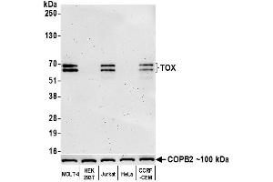 Western Blotting (WB) image for anti-Thymus High Mobility Group Box Protein (TOX) (AA 50-100) antibody (ABIN7453374) (Recombinant TOX anticorps  (AA 50-100))