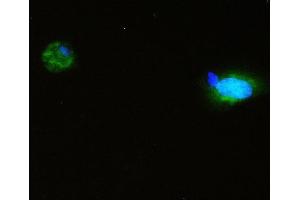 IF analysis of SQSTM1 using anti-SQSTM1 antibody (ABIN3043937). (SQSTM1 anticorps  (N-Term))