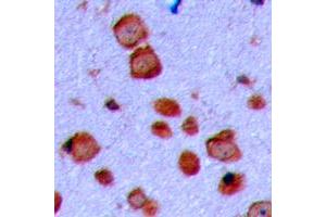 Immunohistochemical analysis of GAP43 staining in human brain formalin fixed paraffin embedded tissue section.