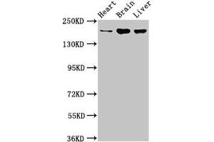 Western Blot Positive WB detected in: Rat heart tissue, Mouse brain tissue, Mouse liver tissue All lanes: ARFGEF2 antibody at 3.