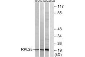 Western blot analysis of extracts from A549/293/COLO cells, using RPL28 Antibody. (RPL28 anticorps  (AA 41-90))