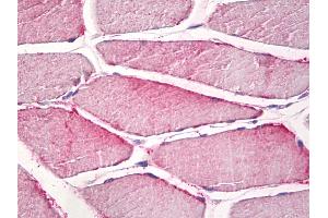 Anti-CPNE6 / N-COPINE antibody IHC staining of human skeletal muscle.
