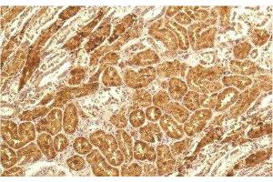 Immunohistochemistry of paraffin-embedded Human kidney tissue using IL8 Monoclonal Antibody at dilution of 1:200. (IL-8 anticorps)
