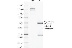 SDS-PAGE Analysis Purified VEGF Mouse Monoclonal Antibody (VG1). (VEGFA anticorps)